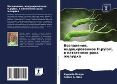 Portada del libro de Воспаление, индуцированное H.pylori, в патогенезе рака желудка