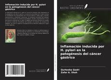 Couverture de Inflamación inducida por H. pylori en la patogénesis del cáncer gástrico