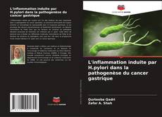 Couverture de L'inflammation induite par H.pylori dans la pathogenèse du cancer gastrique