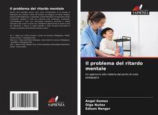 Bookcover of Il problema del ritardo mentale