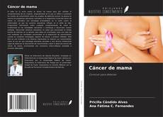 Bookcover of Cáncer de mama
