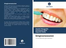 Bookcover of Gingivarezession