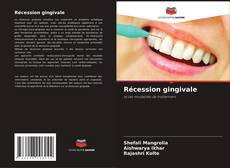 Couverture de Récession gingivale