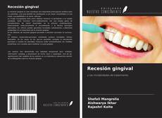 Portada del libro de Recesión gingival