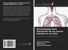 Buchcover von Broncoscopia para extracción de un cuerpo extraño en un niño