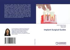 Capa do livro de Implant Surgical Guides 