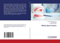 Capa do livro de White Spot Lesions 