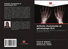 Copertina di Arthrite rhumatoïde et génotypage HLA