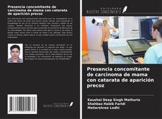 Couverture de Presencia concomitante de carcinoma de mama con catarata de aparición precoz