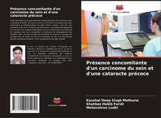 Couverture de Présence concomitante d'un carcinome du sein et d'une cataracte précoce