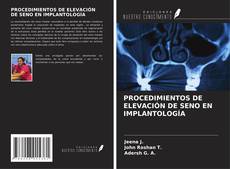 Couverture de PROCEDIMIENTOS DE ELEVACIÓN DE SENO EN IMPLANTOLOGÍA