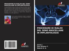 Bookcover of PROCEDURE DI RIALZO DEL SENO MASCELLARE IN IMPLANTOLOGIA