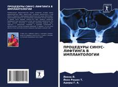 Capa do livro de ПРОЦЕДУРЫ СИНУС-ЛИФТИНГА В ИМПЛАНТОЛОГИИ 