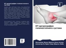 Bookcover of КТ-артрография голеностопного сустава