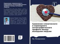 Bookcover of Сравнение клинического и коронарного ангиографического профиля между молодыми людьми