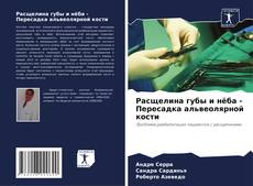 Capa do livro de Расщелина губы и нёба - Пересадка альвеолярной кости 