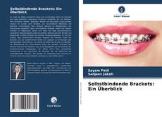 Buchcover von Selbstbindende Brackets: Ein Überblick