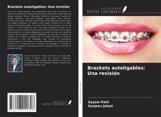 Couverture de Brackets autoligables: Una revisión