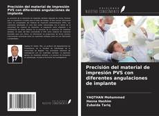 Couverture de Precisión del material de impresión PVS con diferentes angulaciones de implante