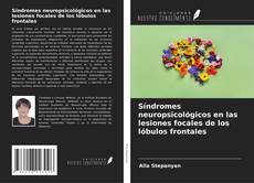 Couverture de Síndromes neuropsicológicos en las lesiones focales de los lóbulos frontales