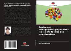 Buchcover von Syndromes neuropsychologiques dans les lésions focales des lobes frontaux