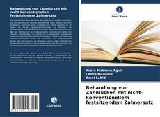 Portada del libro de Behandlung von Zahnlücken mit nicht-konventionellem festsitzendem Zahnersatz