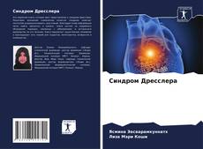 Bookcover of Синдром Дресслера