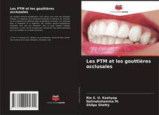 Capa do livro de Les PTM et les gouttières occlusales 