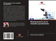 Capa do livro de Biomarqueurs de la maladie parodontale 