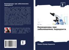 Bookcover of Биомаркеры при заболеваниях пародонта