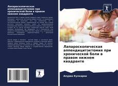 Bookcover of Лапароскопическая аппендицитэктомия при хронической боли в правом нижнем квадранте
