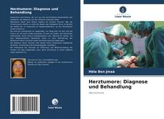 Portada del libro de Herztumore: Diagnose und Behandlung