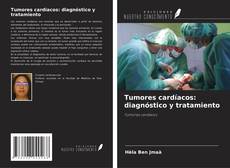 Portada del libro de Tumores cardíacos: diagnóstico y tratamiento