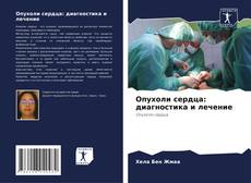 Bookcover of Опухоли сердца: диагностика и лечение