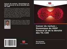 Обложка Cancer du rectum ; Dynamique du VEGF tumoral et de la densité des TIL CD8