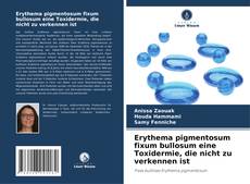 Buchcover von Erythema pigmentosum fixum bullosum eine Toxidermie, die nicht zu verkennen ist