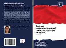 Portada del libro de Острый генерализованный экзантематозный пустулез