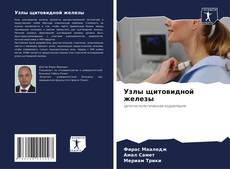 Portada del libro de Узлы щитовидной железы