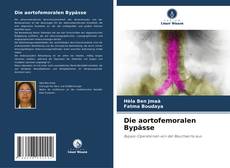 Portada del libro de Die aortofemoralen Bypässe