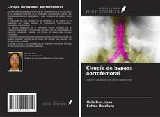 Portada del libro de Cirugía de bypass aortofemoral