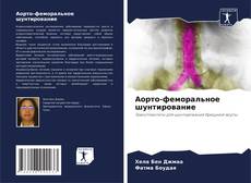 Аорто-феморальное шунтирование kitap kapağı