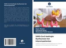 Buchcover von SARS-Cov2-bedingte Dysthyreose bei Intensivpatienten