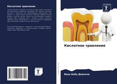 Кислотное травление kitap kapağı