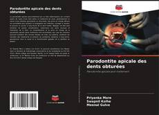 Buchcover von Parodontite apicale des dents obturées