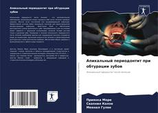 Апикальный периодонтит при обтурации зубов kitap kapağı
