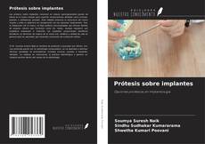 Portada del libro de Prótesis sobre implantes