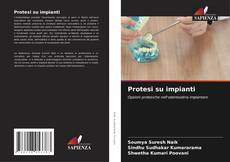 Buchcover von Protesi su impianti