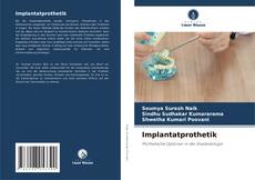 Capa do livro de Implantatprothetik 