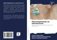 Bookcover of Протезирование на имплантатах