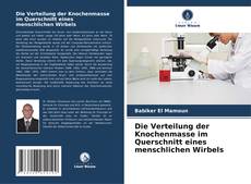 Portada del libro de Die Verteilung der Knochenmasse im Querschnitt eines menschlichen Wirbels